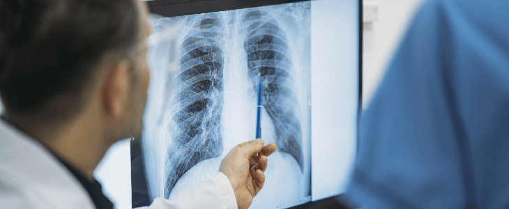 doctor is showing patient an xray of lungs